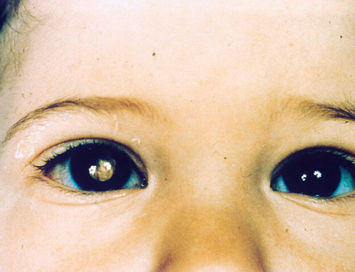 Saiba como uma foto pode prevenir a cegueira do seu filho